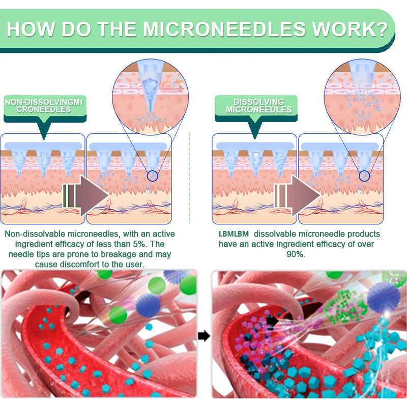 LBMLBM™ NIDDK-Tirzepatide Slimming & health NANO MICRONEEDLE PATCH