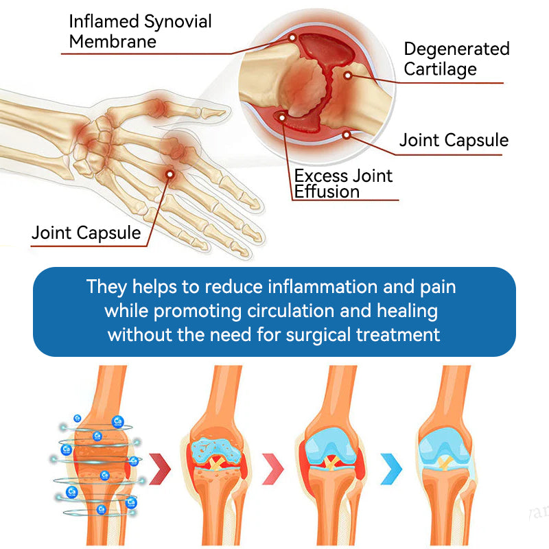 LBMLBM® 𝐁𝐏𝐂-𝟏𝟓𝟕 𝐉𝐨𝐢𝐧𝐭 𝐇𝐞𝐚𝐥𝐢𝐧𝐠 𝐂𝐫𝐞𝐚𝐦 👨‍⚕️𝐓𝐫𝐞𝐚𝐭𝐬 𝐀𝐫𝐭𝐡𝐫𝐢𝐭𝐢𝐬, 𝐍𝐞𝐮𝐫𝐨𝐩𝐚𝐭𝐡𝐲, 𝐑𝐡𝐞𝐮𝐦𝐚𝐭𝐢𝐬𝐦, 𝐒𝐩𝐨𝐫𝐭𝐬 𝐈𝐧𝐣𝐮𝐫𝐢𝐞𝐬 & 𝐌𝐨𝐫𝐞