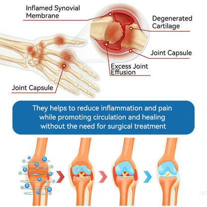 LBMLBM® 𝐁𝐏𝐂-𝟏𝟓𝟕 𝐉𝐨𝐢𝐧𝐭 𝐇𝐞𝐚𝐥𝐢𝐧𝐠 𝐂𝐫𝐞𝐚𝐦 👨‍⚕️𝐓𝐫𝐞𝐚𝐭𝐬 𝐀𝐫𝐭𝐡𝐫𝐢𝐭𝐢𝐬, 𝐍𝐞𝐮𝐫𝐨𝐩𝐚𝐭𝐡𝐲, 𝐑𝐡𝐞𝐮𝐦𝐚𝐭𝐢𝐬𝐦, 𝐒𝐩𝐨𝐫𝐭𝐬 𝐈𝐧𝐣𝐮𝐫𝐢𝐞𝐬 & 𝐌𝐨𝐫𝐞