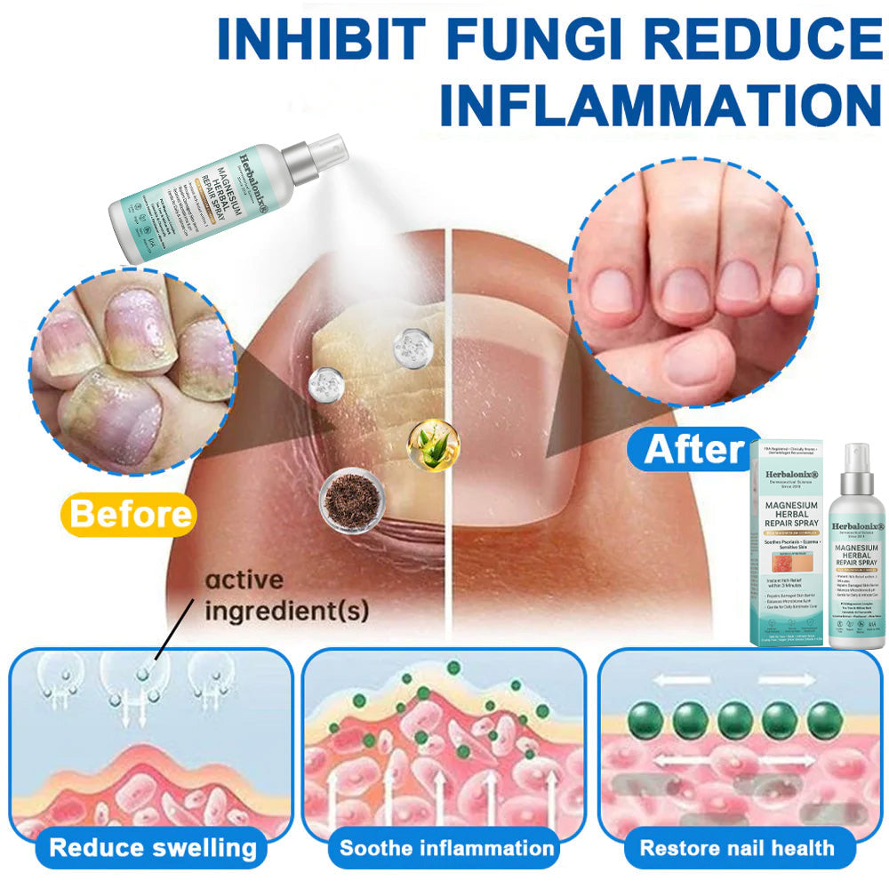 🌿 Herbalonix®  Magnesium Herbal Repair Spray