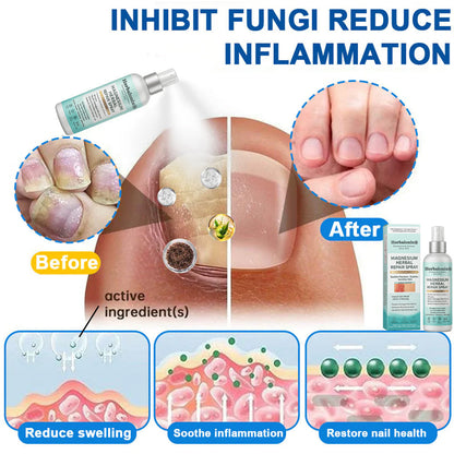 🌿 Herbalonix®  Magnesium Herbal Repair Spray