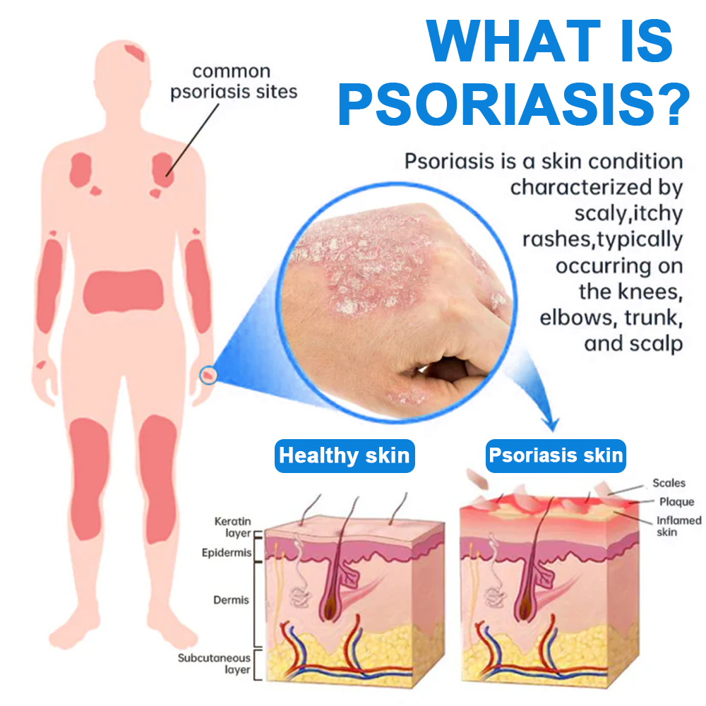 🌿 Herbalonix®  Magnesium Herbal Repair Spray