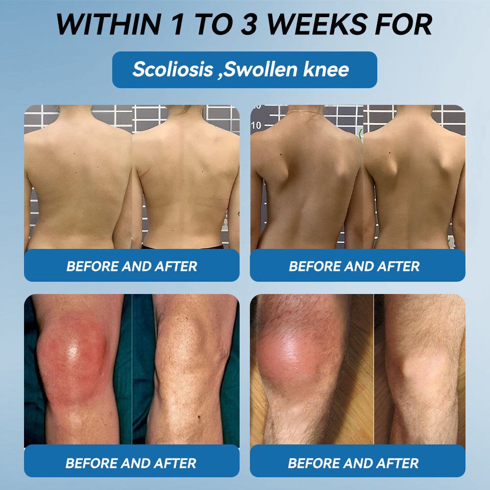 𝐅𝐃𝐀 𝐀𝐩𝐩𝐫𝐨𝐯𝐞𝐝👩‍⚕️|LBMLBM® 𝑩𝐏𝐂-𝟏𝟓𝟕 𝐉𝐨𝐢𝐧𝐭 𝐇𝐞𝐚𝐥𝐢𝐧𝐠 𝐂𝐫𝐞𝐚𝐦🦴 Relief for Arthritis, Neuropathy, Rheumatism & Sports Injuries & 𝐌𝐨𝐫𝐞