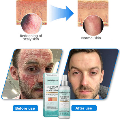 🌿 Herbalonix®  Magnesium Herbal Repair Spray