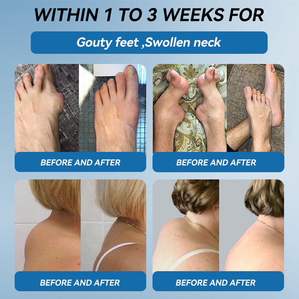 LBMLBM® 𝐁𝐏𝐂-𝟏𝟓𝟕 𝐉𝐨𝐢𝐧𝐭 𝐇𝐞𝐚𝐥𝐢𝐧𝐠 𝐂𝐫𝐞𝐚𝐦 👨‍⚕️𝐓𝐫𝐞𝐚𝐭𝐬 𝐀𝐫𝐭𝐡𝐫𝐢𝐭𝐢𝐬, 𝐍𝐞𝐮𝐫𝐨𝐩𝐚𝐭𝐡𝐲, 𝐑𝐡𝐞𝐮𝐦𝐚𝐭𝐢𝐬𝐦, 𝐒𝐩𝐨𝐫𝐭𝐬 𝐈𝐧𝐣𝐮𝐫𝐢𝐞𝐬 & 𝐌𝐨𝐫𝐞