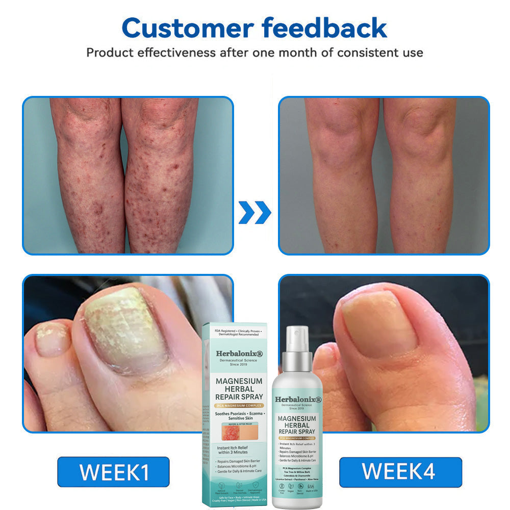 🌿 Herbalonix®  Magnesium Herbal Repair Spray
