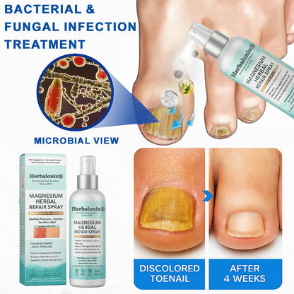 🌿 Herbalonix®  Magnesium Herbal Repair Spray