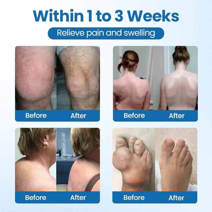 Timilk® BPC-157 Joint Repair Cream