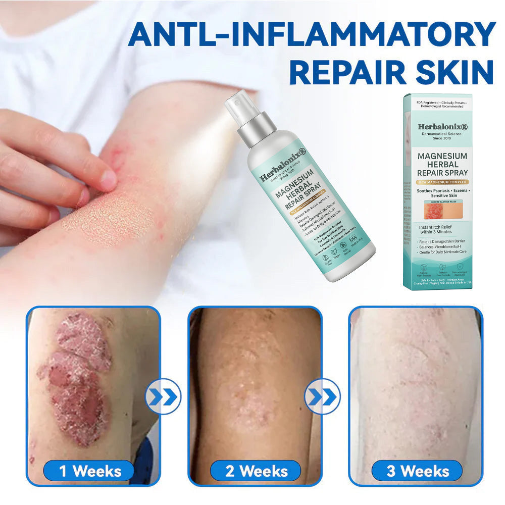 🌿 Herbalonix®  Magnesium Herbal Repair Spray
