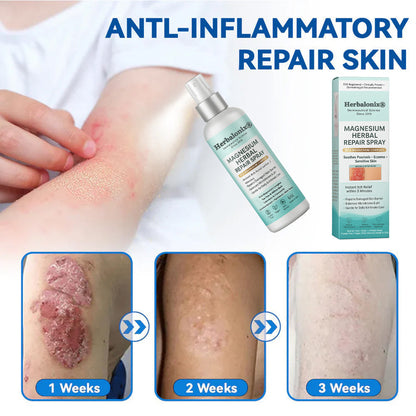 🌿 Herbalonix®  Magnesium Herbal Repair Spray