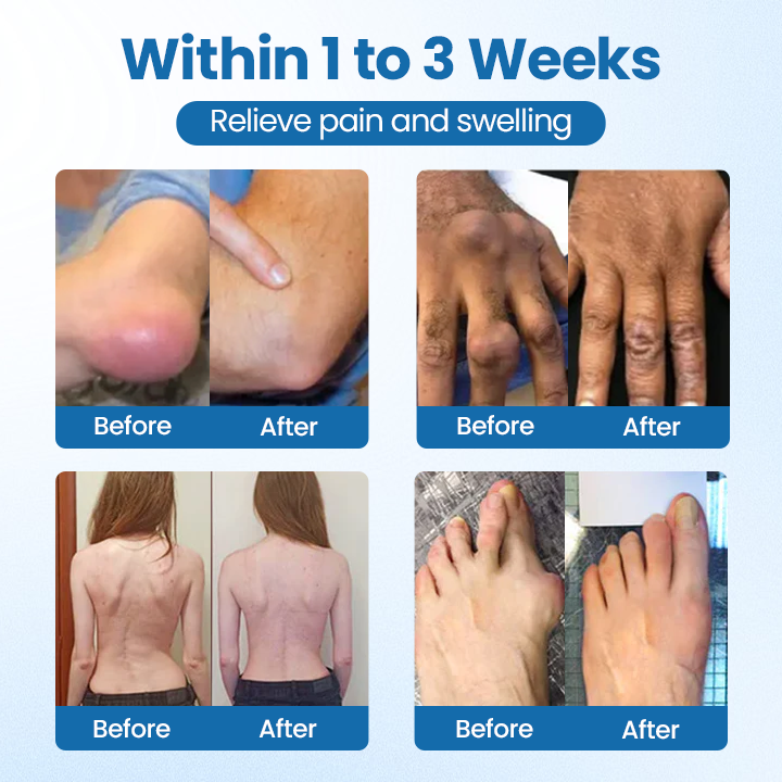 Timilk® BPC-157 Joint Repair Cream