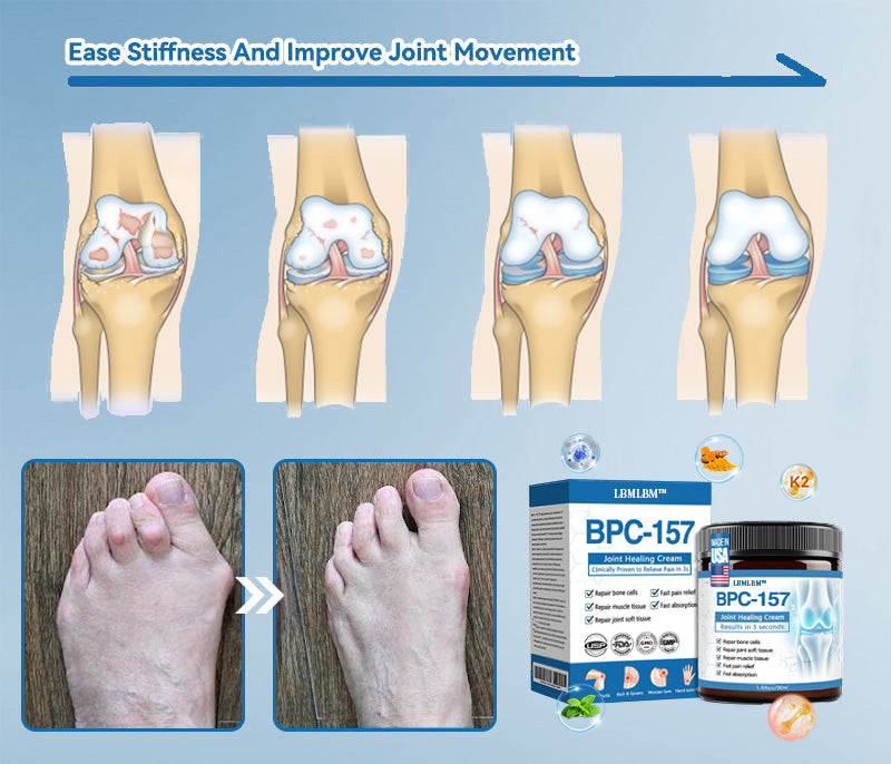𝐅𝐃𝐀 𝐀𝐩𝐩𝐫𝐨𝐯𝐞𝐝👩‍⚕️|LBMLBM® 𝑩𝐏𝐂-𝟏𝟓𝟕 𝐉𝐨𝐢𝐧𝐭 𝐇𝐞𝐚𝐥𝐢𝐧𝐠 𝐂𝐫𝐞𝐚𝐦🦴 Relief for Arthritis, Neuropathy, Rheumatism & Sports Injuries & 𝐌𝐨𝐫𝐞